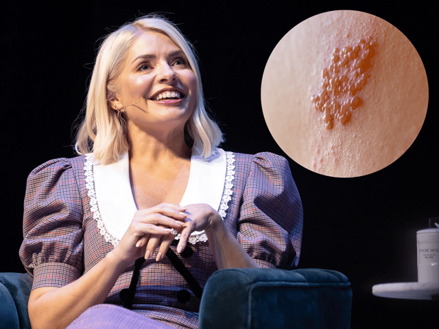 Holly Willoughby will have to wait longer to reunite with Philip Schofield as she has shingles - Credit: Getty Images / Adobe