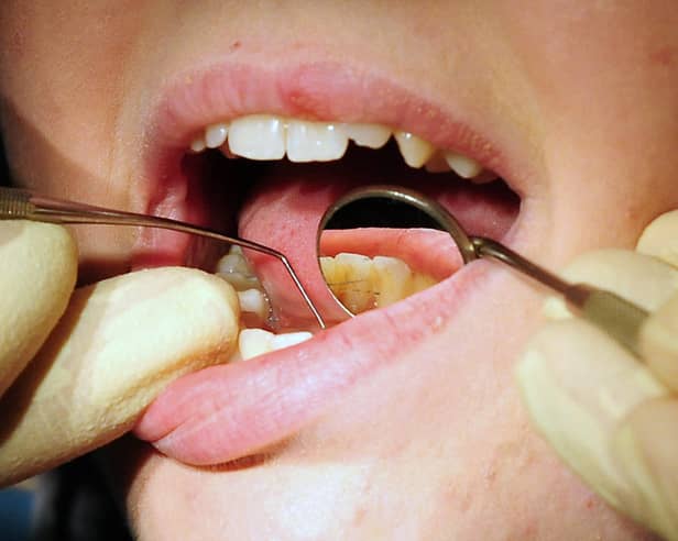Dentists in Blackpool removed teeth from a record number of children in the last year