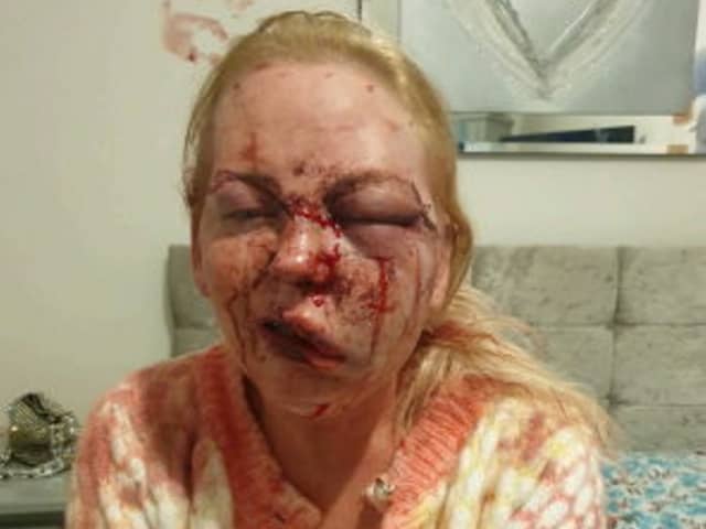 The woman was left with a series of injuries including a brain injury and a broken jaw after she was brutally attacked by Karl Machin, 44, who filmed it on his mobile phone.