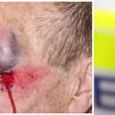 Lancashire Police are appealing for the public's help after an eldery man was assaulted.