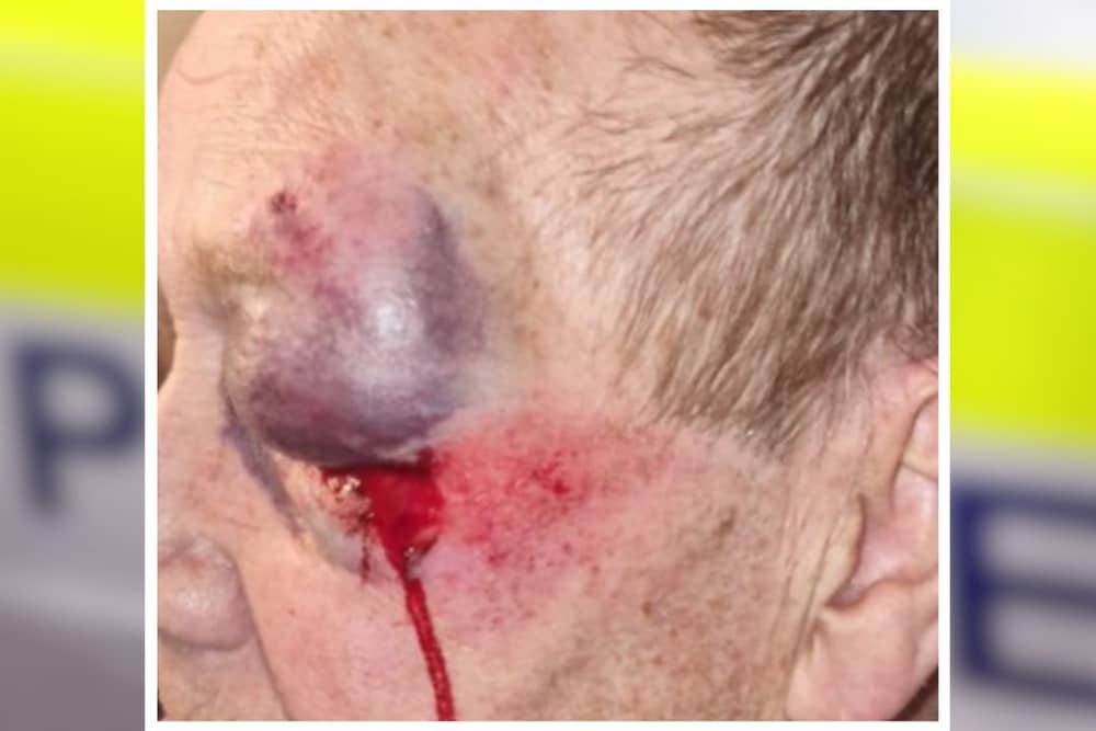 Lancashire Police are appealing for the public's help after an eldery man was assaulted.