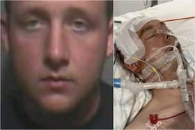 Scott Sutcliffe left Lee Burns with a fractured skull and two bleeds on the brain (Credit: Lancashire Police)