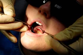 There were more than 1,100 hospital admissions in Lancashire to remove children's decaying teeth (Credit: PA)
