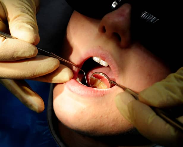 There were more than 1,100 hospital admissions in Lancashire to remove children's decaying teeth (Credit: PA)