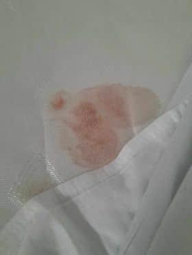 Blood on the sheet in the hotel room