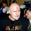 John Fury, father of boxer Tyson Fury, with blood on his face during a media day in Riyagh. 