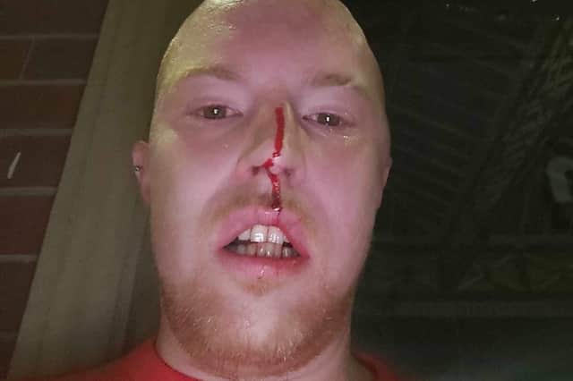 Jordan's injuries after the attack