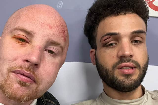 Jordan, left, Daniel, right, after they were assaulted outside Blackburn station