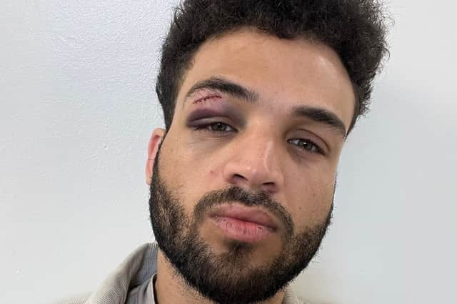Daniel's injuries after the attack