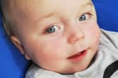 Damion sadly died from an unsurvivable brain injury (Credit: Lancashire Police)