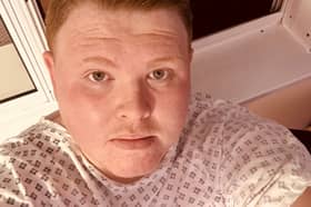 Tom Moss who has been left with a hole in his leg after developing a rare injury four years after a car crash