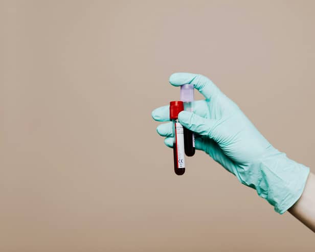Cases of HIV amongst heterosexual patients in England have risen by more than 30% since 2022.