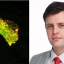 Dr Anthony Aggidis and the brain of a fruit fly with Tau expressed in a neuronal circuit used by the fly in olfactory memory. The red shows where Tau is building up in clusters along the neurons