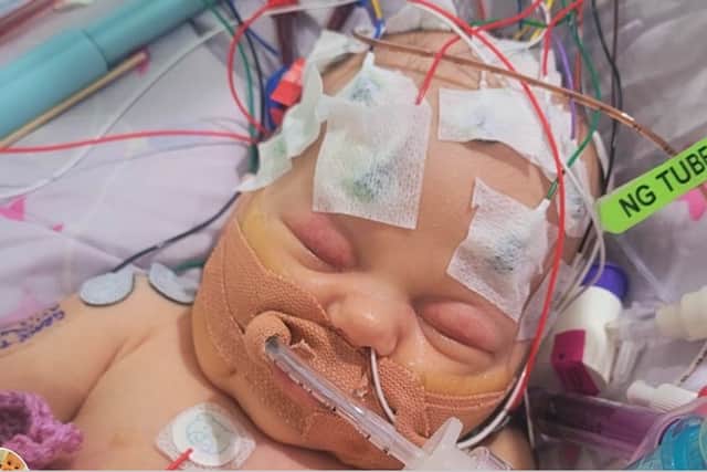 Litle Grace Thorpe was seriously ill in hospital with undetected heart defects