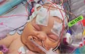 Litle Grace Thorpe was seriously ill in hospital with undetected heart defects