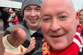 Michael Muldoon is "lucky to be alive" after he was attacked outside a football ground and left with a serious head injury