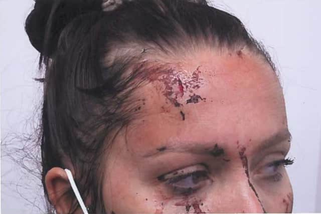 Jurors heard Ms Dawes had suffered two years of violence and abuse at the hands of Wellings