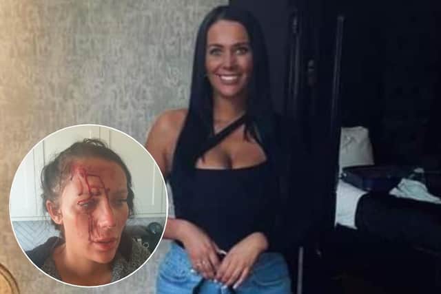 Kiena Dawes took her own life after being assaulted and domestically abused by her partner