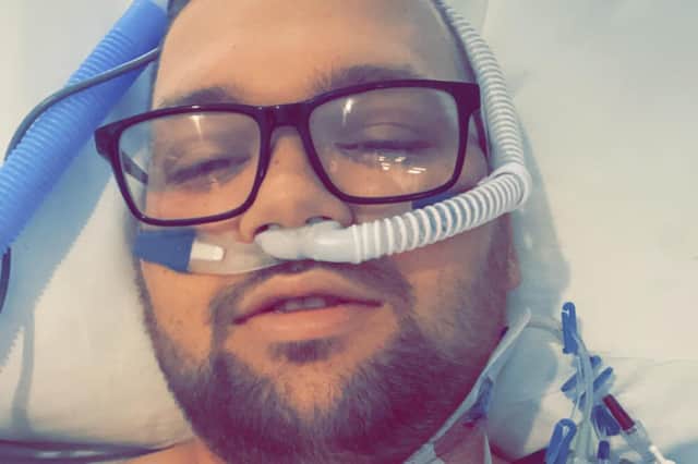 After he started throwing up blood, James was rushed to intensive care in May this year where he was put on oxygen and in a coma