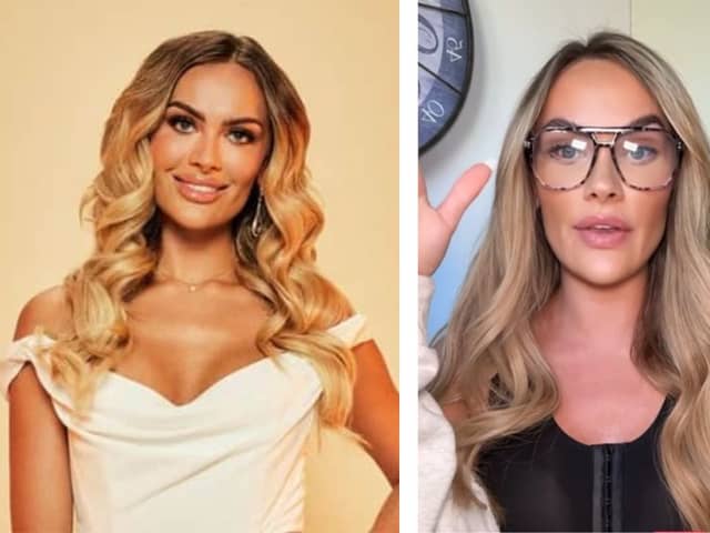 Married at First Sight star Amy Kenyon from Lancashire has shared some worrying health news s with her fans.