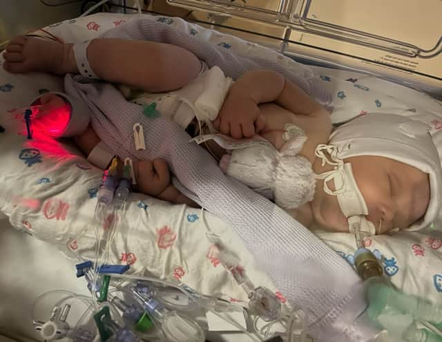 Ayla was born “pale, floppy and not breathing” at Blackpool Victoria Hospital. She suffered seizures and her care was transferred to Royal Preston Hospital, where she died two weeks later in Shannon’s arms