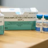 Measles is a highly contagious viral infection, which can have serious health consequences.