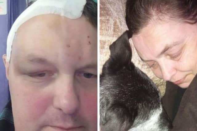 Adrian Haynes, 53, from Blackpool, who had a brain tumour which his dog also had but sadly passed away from. 