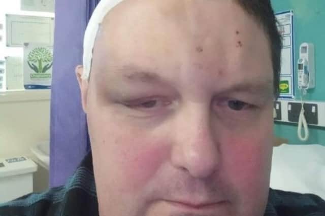 Adrian recovering after an operation.  