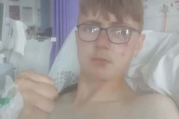 Apprentice roofer Miles is recovering in hospital after he was seriously injured falling 30ft off a roof in St Annes