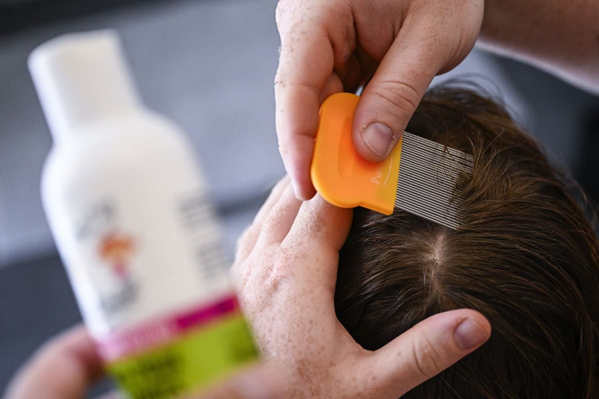 How to spot head lice and treatment options as parents warned after ...