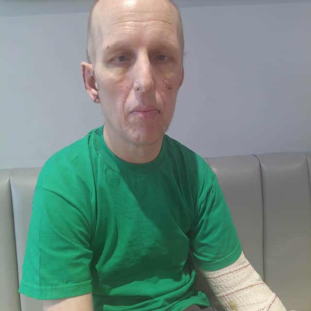 Mark Daniel, 47, who lost his left arm in a dog attack, says he has “forgiven but not forgotten”.