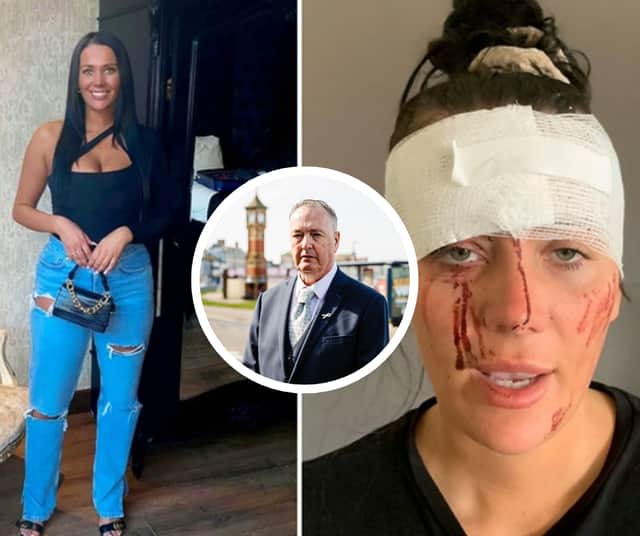 Police boss inspired by Kiena Dawes case to change law on domestic abuse deaths