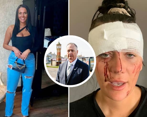 Police boss inspired by Kiena Dawes case to change law on domestic abuse deaths