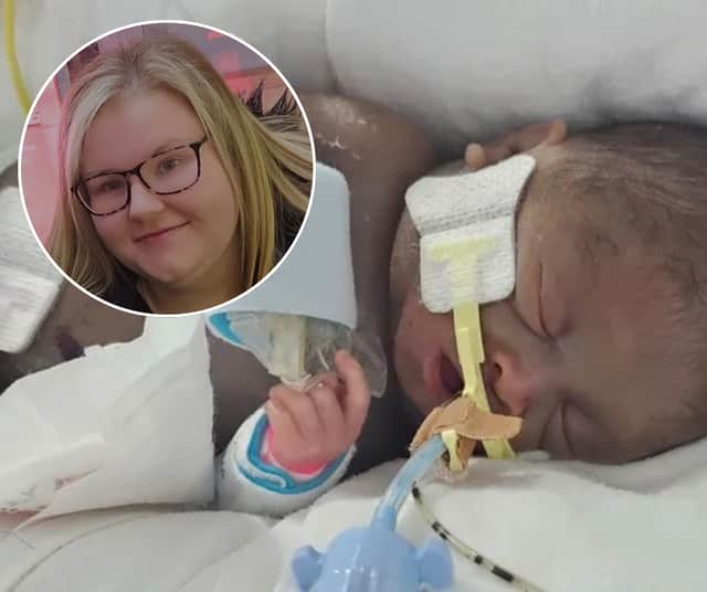 New mum Chloe Hamilton gave birth to Abi last month with the baby weighing just 434g - the weight of two hamsters. She has now revealed he has made it through life saving stomach surgery
