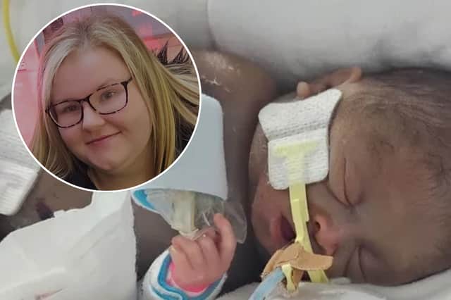 New mum Chloe Hamilton gave birth to Abi last month with the baby weighing just 434g - the weight of two hamsters. She has now revealed he has made it through life saving stomach surgery