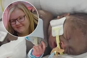 New mum Chloe Hamilton gave birth to Abi last month with the baby weighing just 434g - the weight of two hamsters. She has now revealed he has made it through life saving stomach surgery
