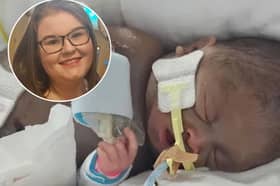 Little baby Abi died after life-saving surgery at Alder Hey Hospital.