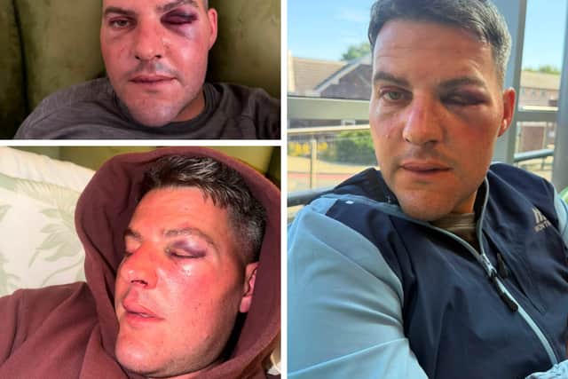 A Fylde coast business owner has spoken of her horror after she and her partner suffered an alleged assault while on an evening out.