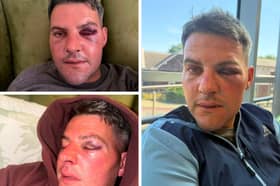 A Fylde coast business owner has spoken of her horror after she and her partner suffered an alleged assault while on an evening out.