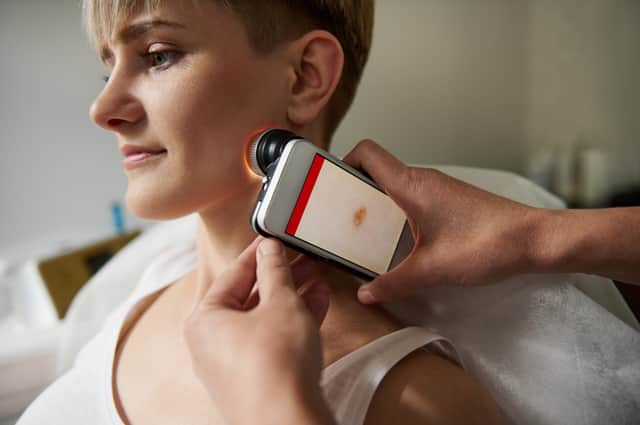 An example of equipment that may be used by a teledermatology service