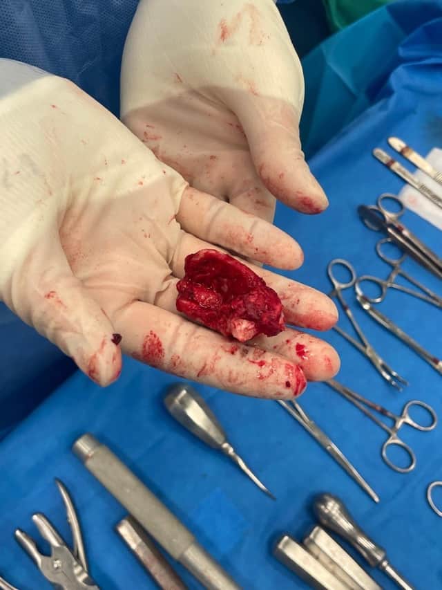 One of the ear teeth immediately after removal (credit Oakhill Vets)