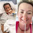 Mum Lisa Martin, 47, from Thornton thought the lump in her throat was down to a lingering cold - but it was actually a hidden sign she has tongue cancer