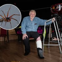 I was bitten by a spider while renovating my Marton home and spent three weeks in Blackpool Victoria Hospital