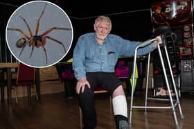Glenn Priestley had to spend FOUR days in hospital after suffering what he believes to be a bite from a noble False Widow spider. Photo: Lucinda Herbert