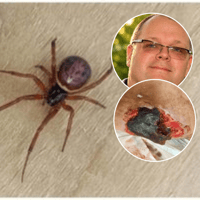 My wife endured a horrific skin infection after suspected spider bite in Blackpool - and  still needs help