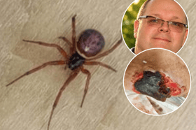 Martin Jones (inset)  said it was believed the badly infected wound to his wife's leg (inset)  was likely to have been caused by a bite by a False Widow spider