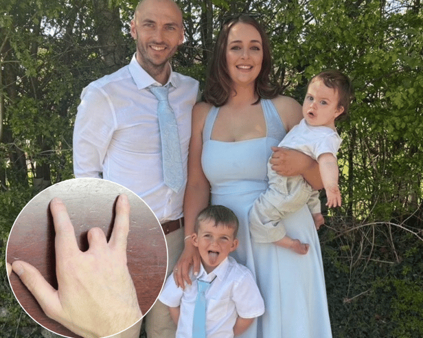 A young dad has been awarded a "seven figure" payout after his life was ruined by a horrific workplace saw accident - that left him with two missing fingers. 