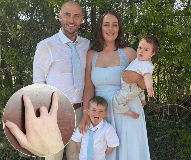 A young dad has been awarded a "seven figure" payout after his life was ruined by a horrific workplace saw accident - that left him with two missing fingers.