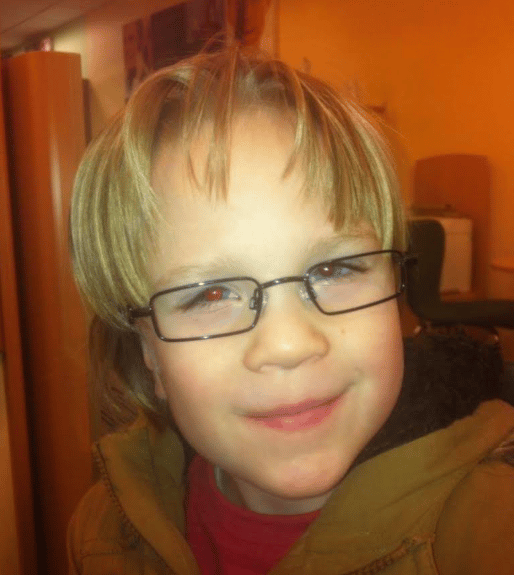 Riley has been partially blind since he was a baby.