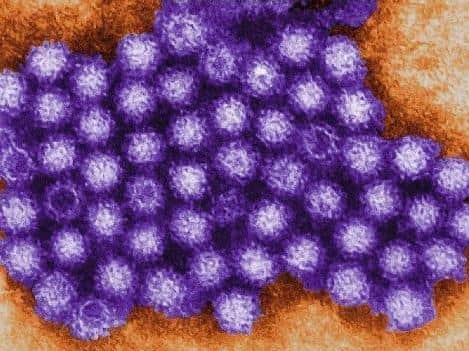 A microscopic view of the norovirus